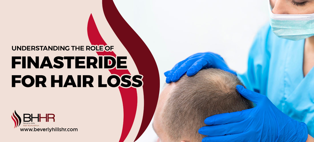 Finasteride for Hair Loss